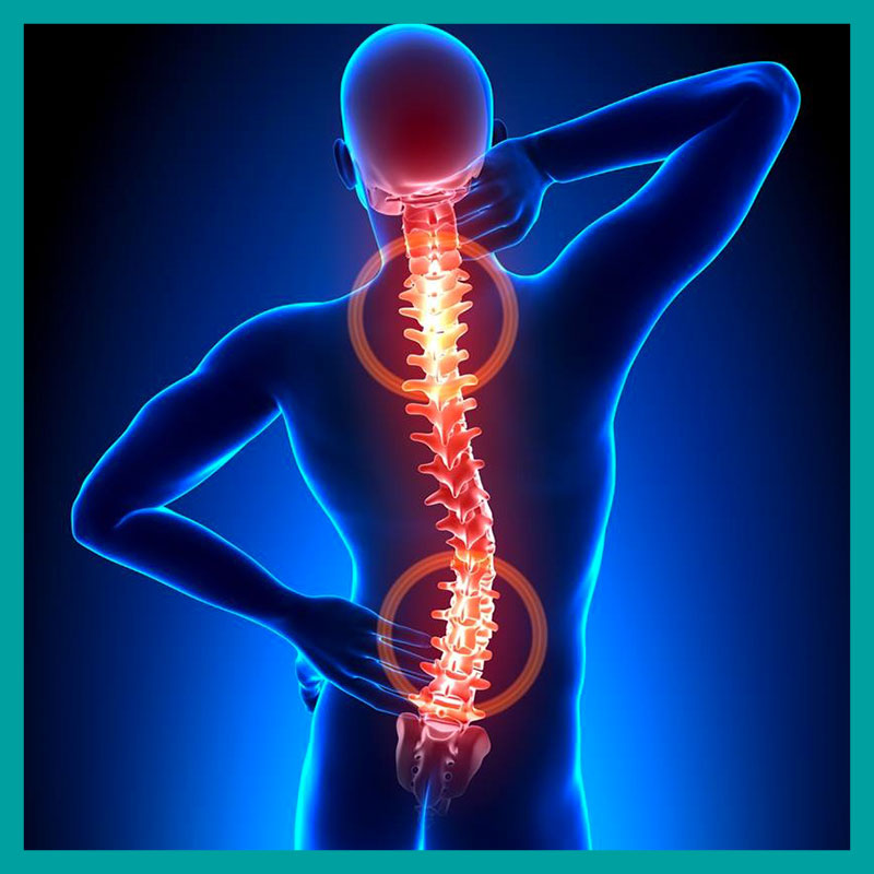 Rieducazione Posturale Globale